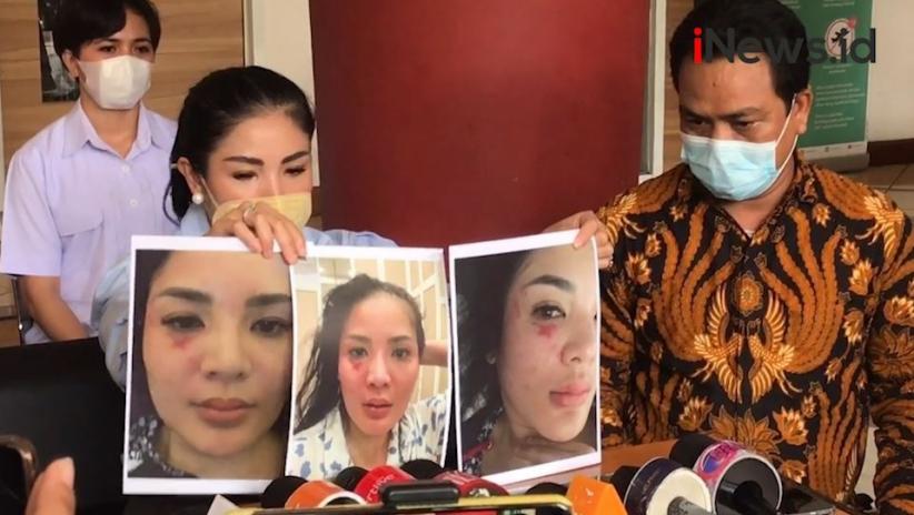 Pergoki Suami Selingkuh, Nindy Ayunda Dipukul