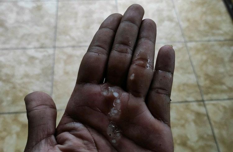 Hujan Es Landa Kabupaten Sleman, Kandang Ayam di Pakem Ambruk