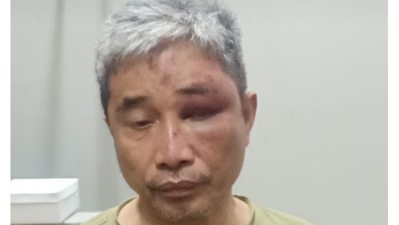 Hasil Visum, Muhammad Kece Alami 9 Luka Lebam di Wajah dan Pinggang