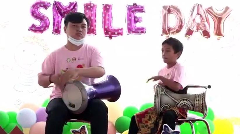 Senyum Pasien Bibir Sumbing Rayakan World Smile Day 2021 - Bagian 3