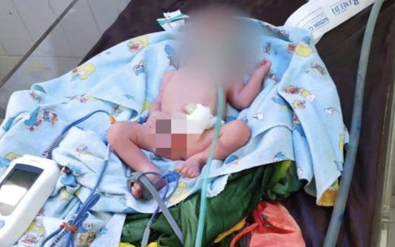 Kasihan, Bayi Laki-Laki Ditemukan Nangis Dalam Kantong Plastik di Semak