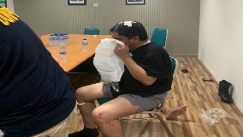 Kondisi Terkini Ade Armando, Beberapa Kali Muntah dan Keluarkan Darah