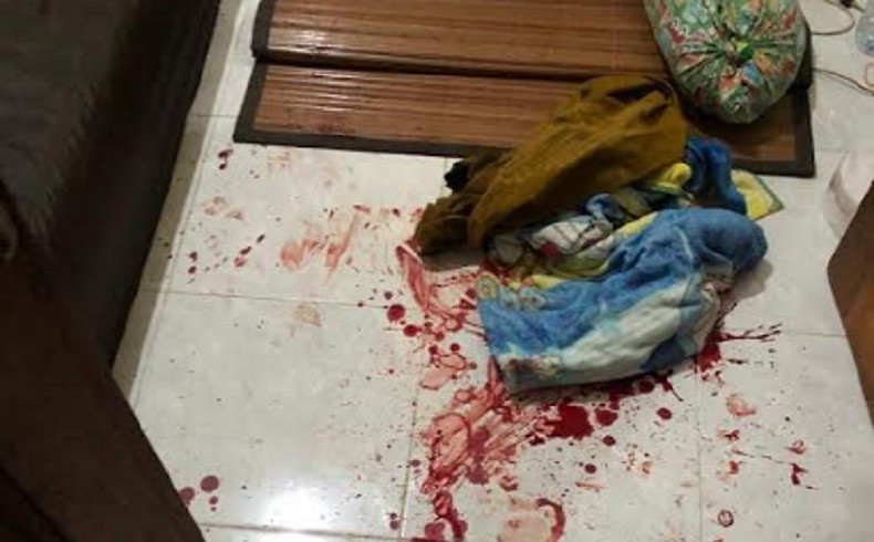 Penghuni Kos di Denpasar Bersimbah Darah Dibacok Orang Tak Dikenal saat Tidur