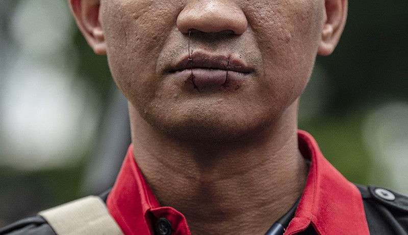 Aksi Jahit Mulut Tuntut Berantas Mafia Tanah - Bagian 1