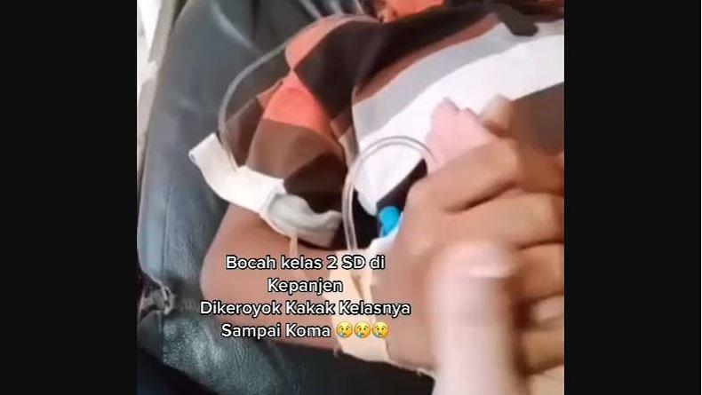 Kasus Bocah SD Dianiaya Kakak Kelas hingga Masuk RS, Ini Kata Polres Malang
