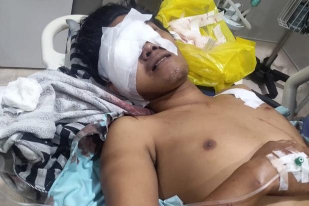  Warga Mestong Jambi Luka Parah Diserang Beruang saat Berada di Kebun