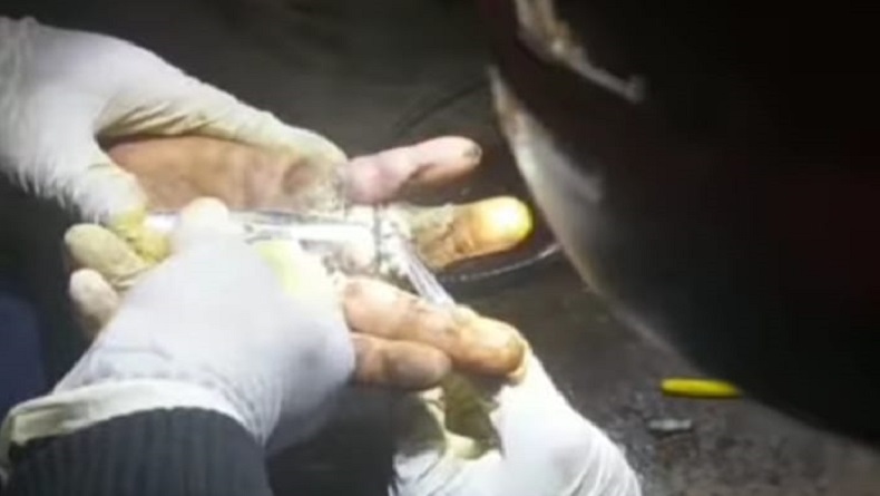 Kasus Terjepit Cincin Sering Terjadi di Garut, Paling Ngeri Jari Membusuk