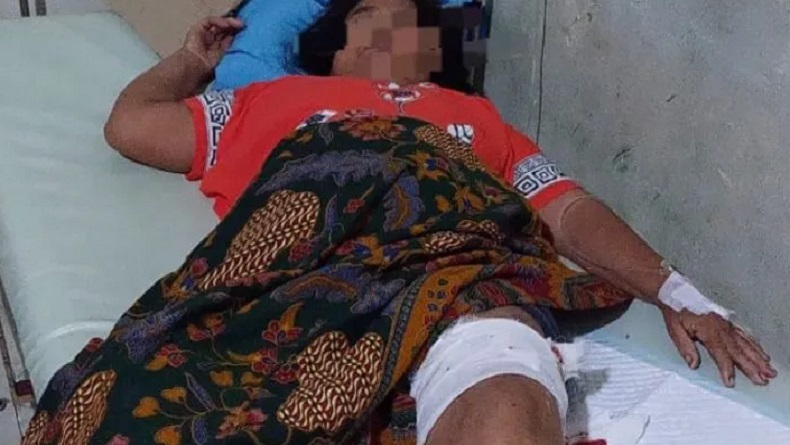 Pasutri di Tabalong Diserang Beruang Liar, Kaki Digigit 