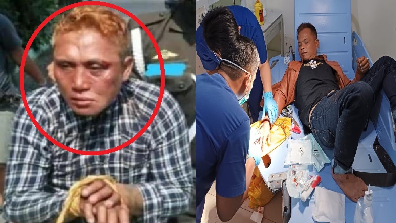 Dadang Buaya Kembali Berulah, Bacok 2 Orang di Pameungpeuk Garut