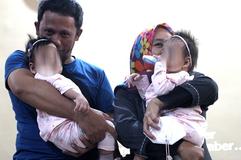 Momen Haru Bayi Kembar Siam Berhasil Dipisah Kembali ke Pangkuan Orang Tua di Malang - Bagian 1