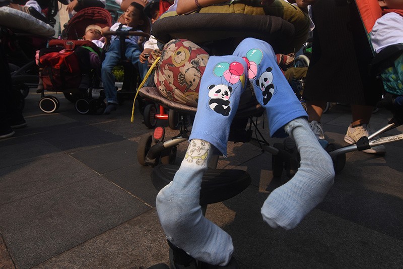 Peringatan Hari Celebral Palsy Sedunia - Bagian 1