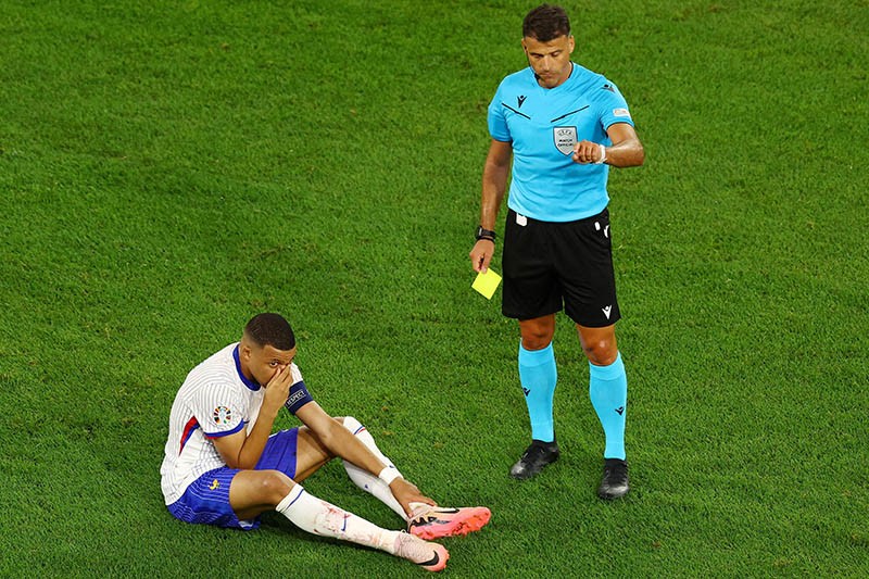 Reaksi Kylian Mbappe Cedera Hidung Berdarah hingga Kartu Kuning - Bagian 1