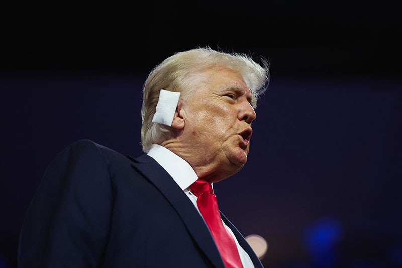 Penampakan Donald Trump Pakai Perban pada Telinga Kanan - Bagian 1