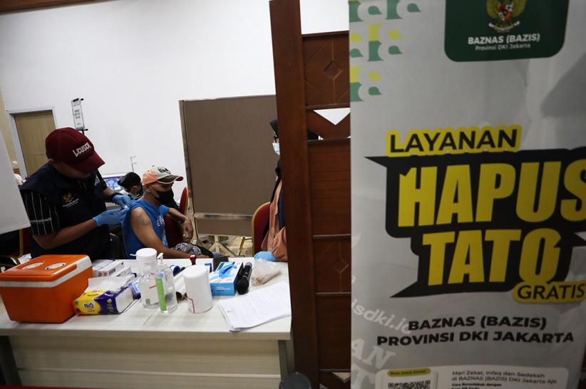 Layanan Hapus Tato Gratis di Balai Kota Jakarta, Ini Jadwalnya - Bagian 2