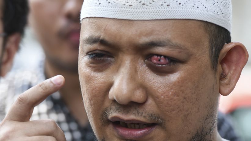 Wadah Pegawai KPK Desak Jokowi Bentuk TGPF Kasus Novel Baswedan - Bagian 3