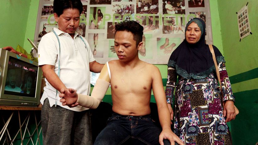 Melihat Proses Pembuatan Kaki dan Tangan Palsu - Bagian 11