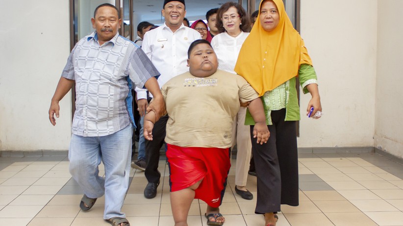 Sulit Napas, Satia Putra Bocah Obesitas Asal Karawang Tidur sambil Duduk