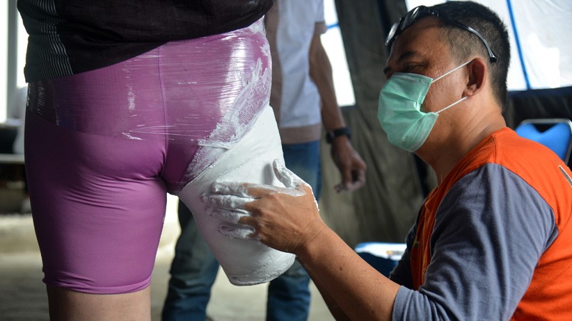Pemerintah Aceh Salurkan 100 Kaki Palsu untuk Penyandang Disabilitas - Bagian 3